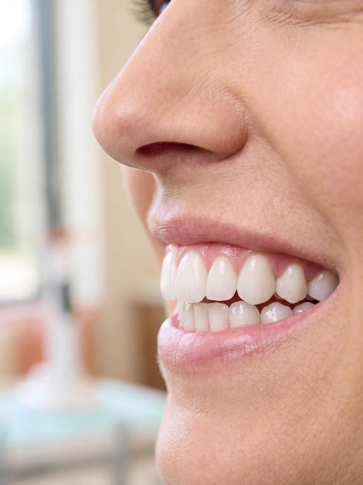 A close profile of a patient's bright natural smile after cosmetic work